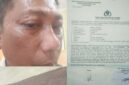Jurnalis di Kabupaten Toba jadi korban kekerasan.