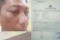 Jurnalis di Kabupaten Toba jadi korban kekerasan.